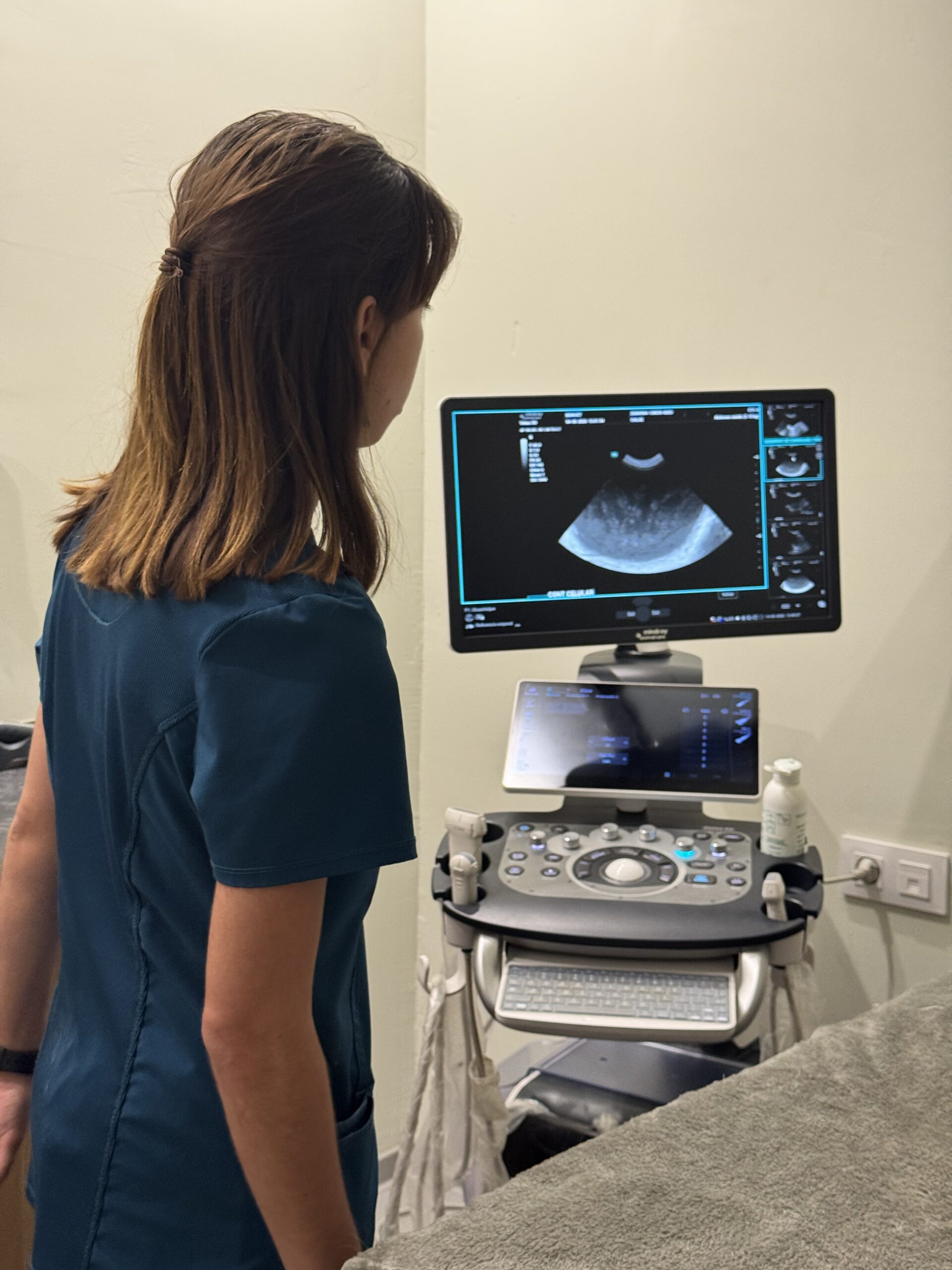 Ecografista revisando monitor de ultrasonido con imagen diagnóstica en clínica médica